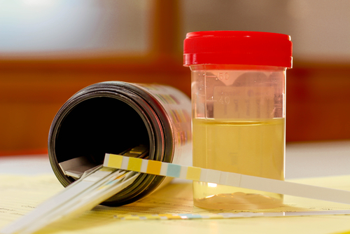 Urine drug test cup and strips